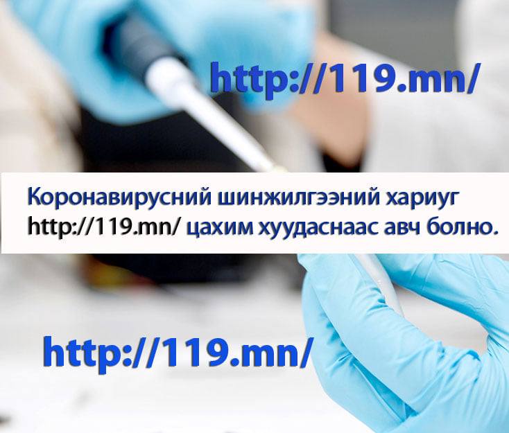 “КОВИД-19” халдварын зорилтот болон сайн дурын шинжилгээнд 34.402 хүн хамрагдаад байна